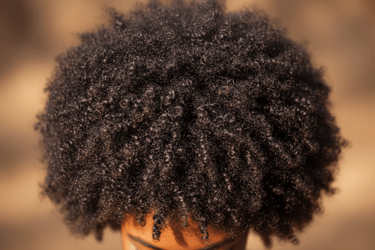 Embrace Your Natural Hair - Ndop Botanical Hair Oil